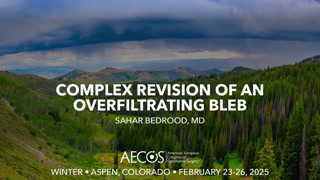 Complex revision of an overfiltrating bleb